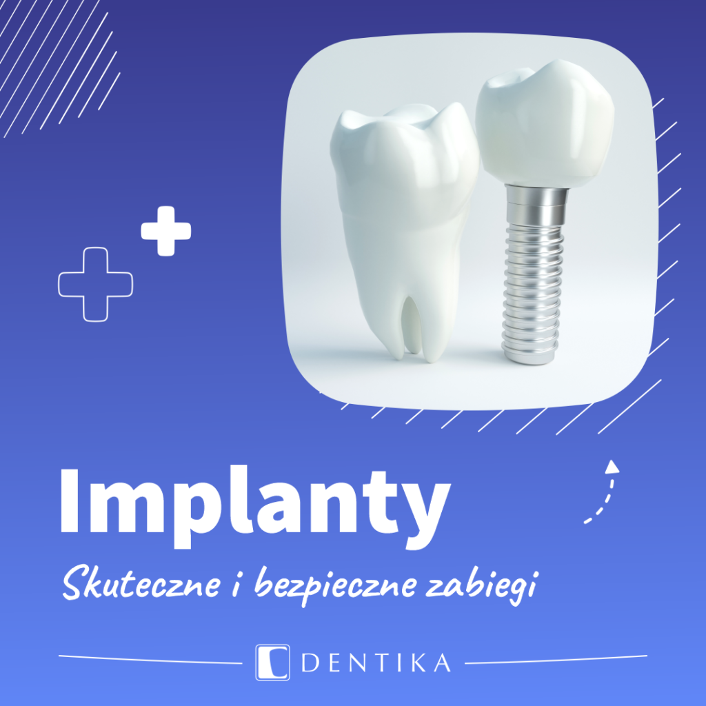 Dentika_post_ofertowy_stomatologia
